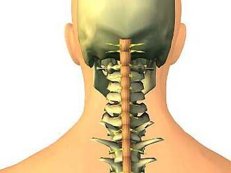 Osteocondrose da rexión cervical