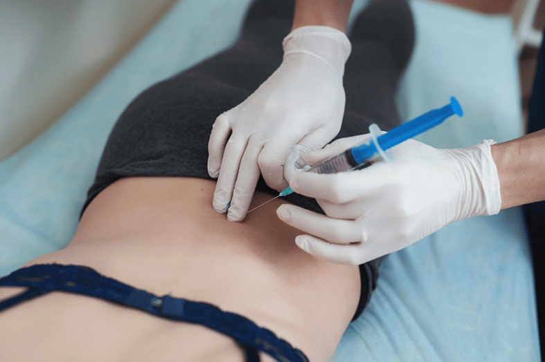 bloqueo para osteocondrose lumbar