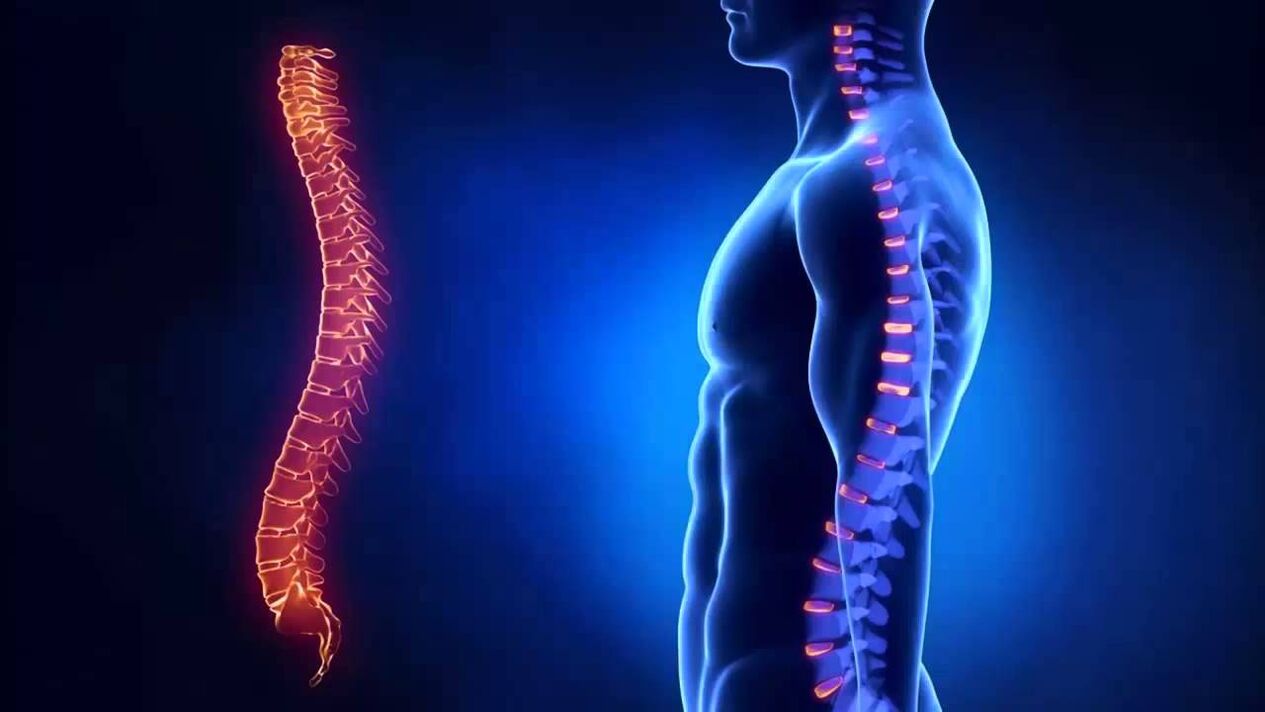 osteocondrose